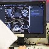 Face à l'augmentation des coûts, le Contrôle fédéral des finances recommande de mieux contrôler l'utilisation des techniques d'imagerie (archives). KEYSTONE/CHRISTIAN BEUTLER